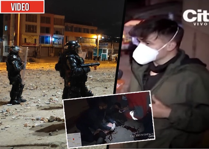 Periodista fue apuñalado por policía en Bogotá