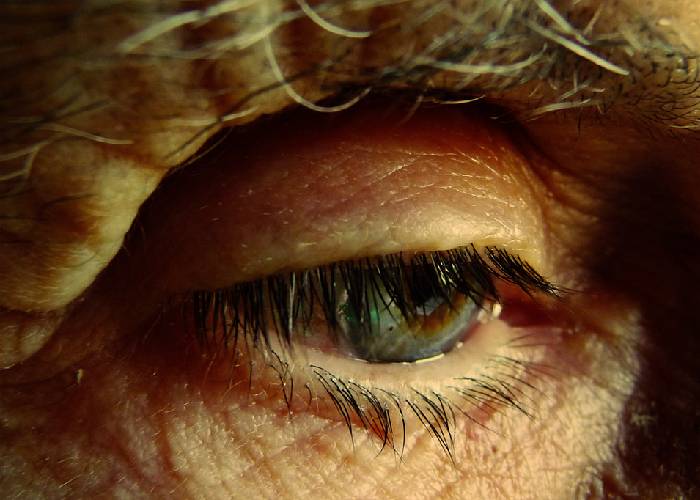 En las lagunas de una mente que se apaga: Alzheimer