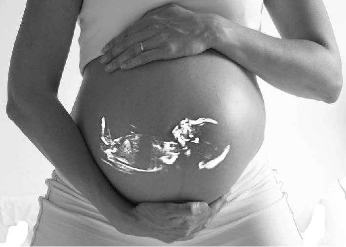 La pesadilla que vive una mujer cuando un bebé muere en su vientre