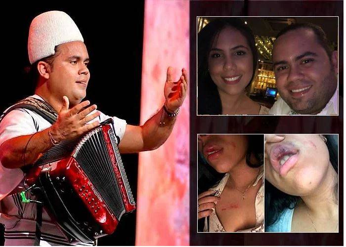 El primer rey vallenato arhuaco se defiende de las acusaciones de agresión a su expareja