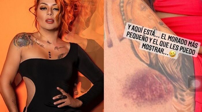  - Casi se mata: la terrible caída de Marbelle en un concierto