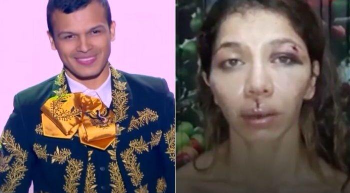  - El imitador de Yo me llamo que fue denunciado por golpear a una mujer en 2018