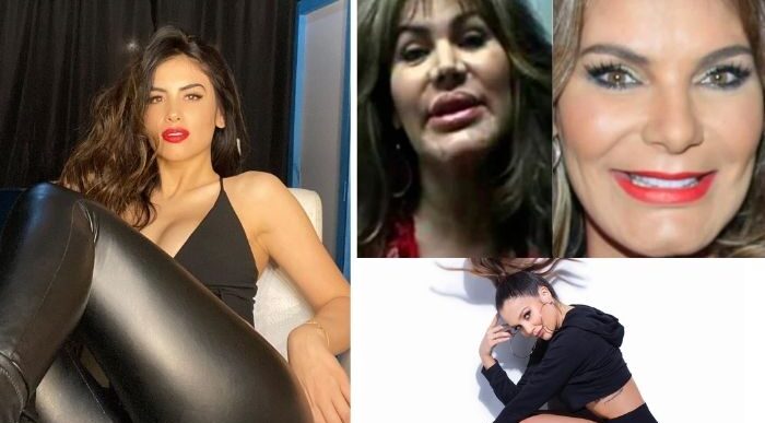  - Las divas que arruinaron su cuerpo con cirugías estéticas