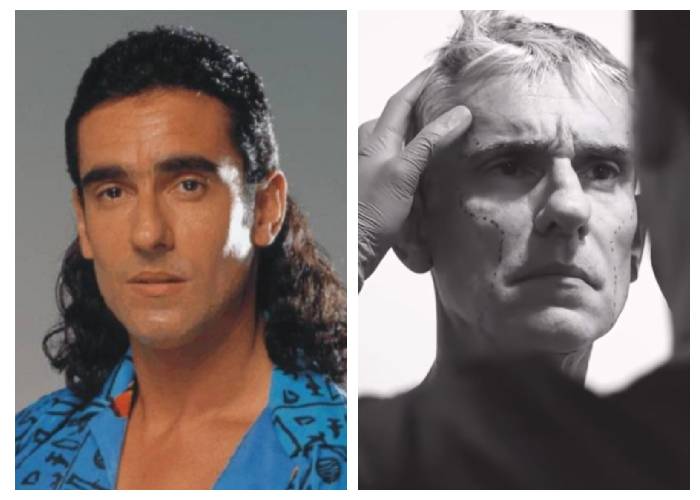 El nuevo Miguel Varoni, luego de su cirugía estética para quedar joven 'como Maluma'