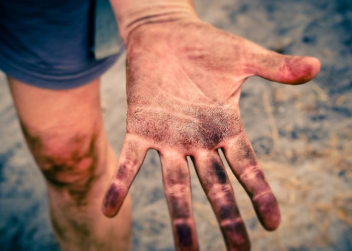 Tercos y negacionistas: los que quieren tapar el sol (y el pésimo estado de cosas) con un dedo