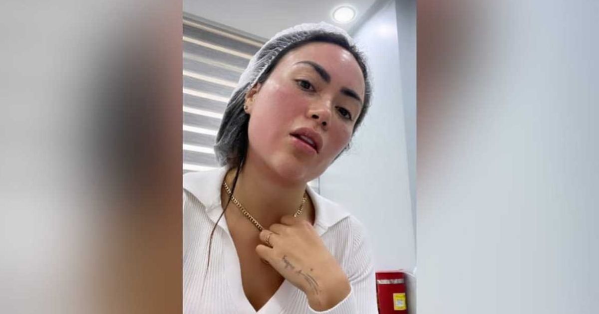 El platal que Epa Colombia va a gastar para que su piel se vea más joven