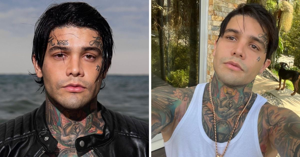 ¿Se aburrió de ser guiso? Yeferson Cossio se borrará los tatuajes que tiene en su rostro