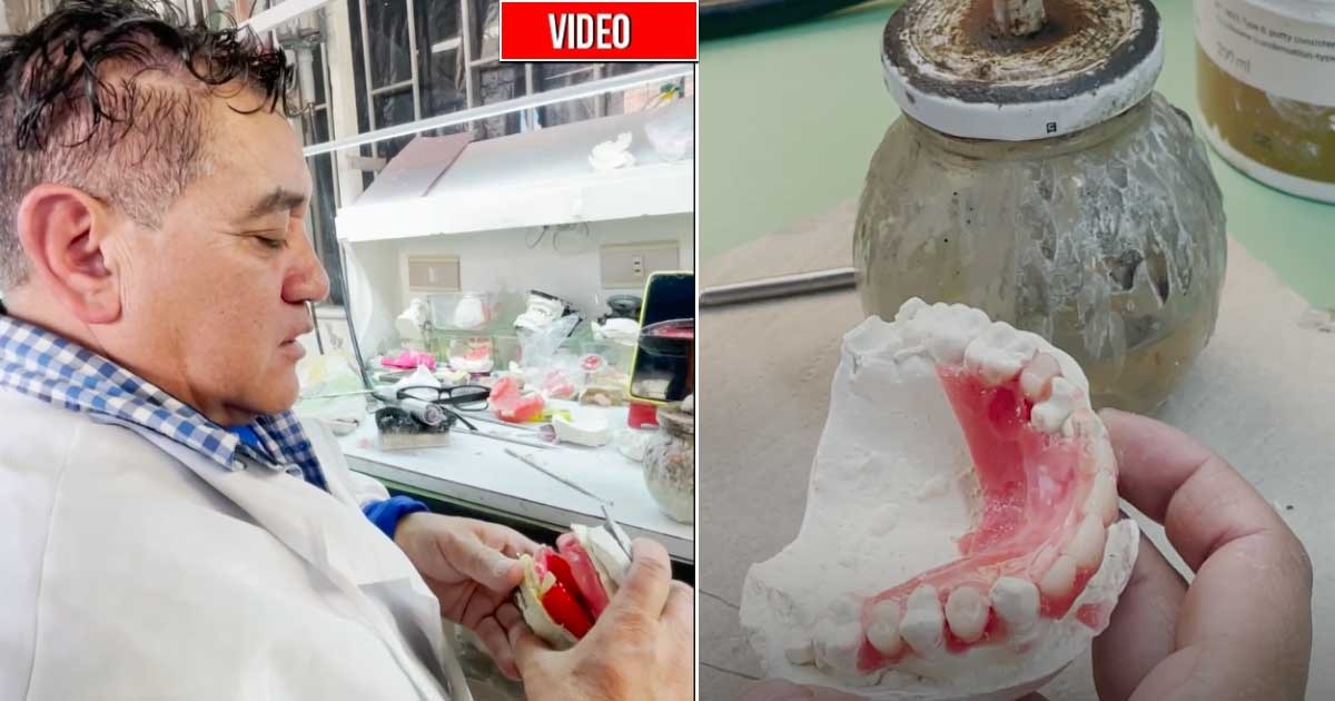 Con latas de cerveza y en una terraza de Bogotá, se hacen prótesis dentales a 120 mil pesos