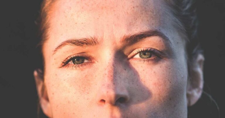  - Los lunares son unos chismosos