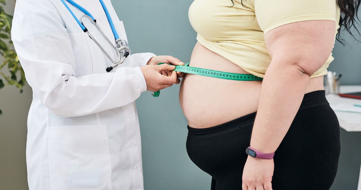 Mitos y verdades sobre la cirugía bariátrica