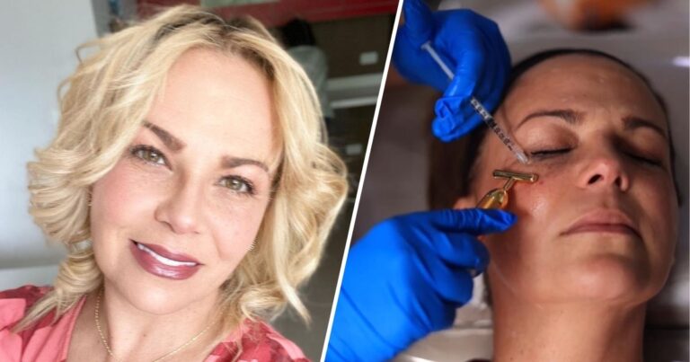 Carolina Sabino - "Se ve más vieja" El palo a Carolina Sabino por inyectarse Botox en la cara