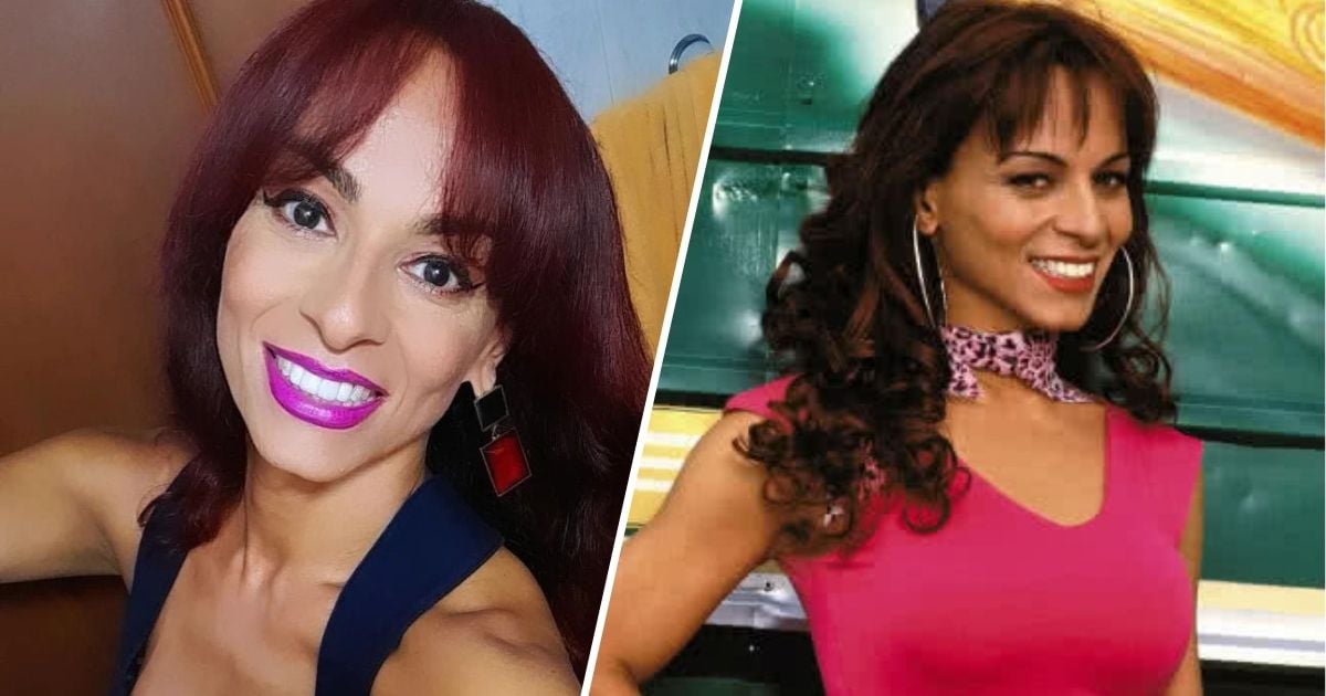 Le quemaron el cuerpo: el drama que vive Endry Cardeño por culpa de la vanidad