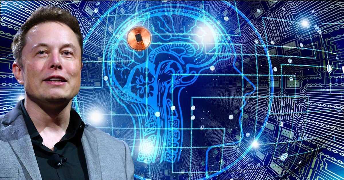 Elon Musk ensayará implantes cerebrales en humanos