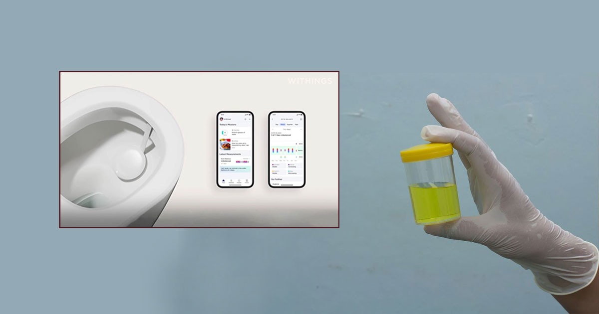 No más laboratorios: pruebas de orina caseras