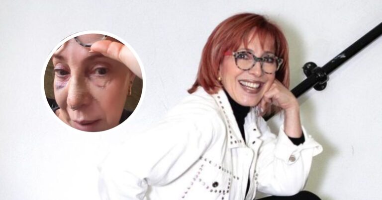 Yaneth Waldman accidente - Fracturas y moretones: El accidente que sufrió Yaneth Waldman por hacer lo que más ama