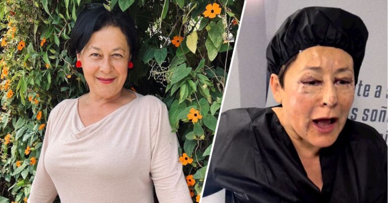 Alina Lozano antes y después de cirugías - Las cirugías de Alina Lozano para ser la prometida perfecta: Lipopada, botox y relleno de labios