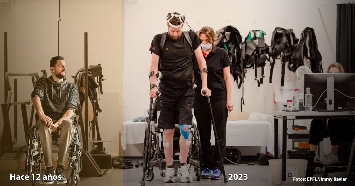 Un paralítico holandés vuelve a caminar gracias a nuevo implante cerebral
