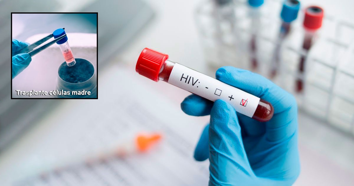 Solución definitiva para el VIH: trasplante de células madre