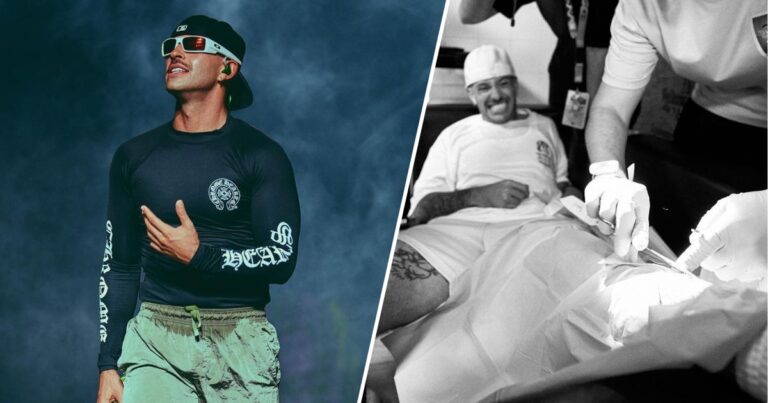 Feid - El accidente que Feid sufrió en su tour por Europa