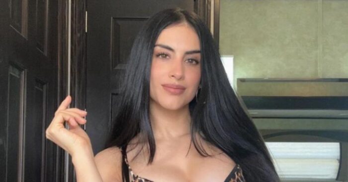  - Famosas que usaron biopolímeros