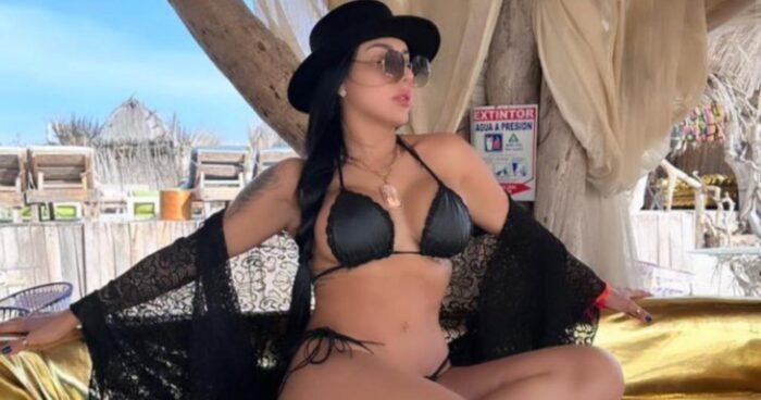  - Famosas que usaron biopolímeros