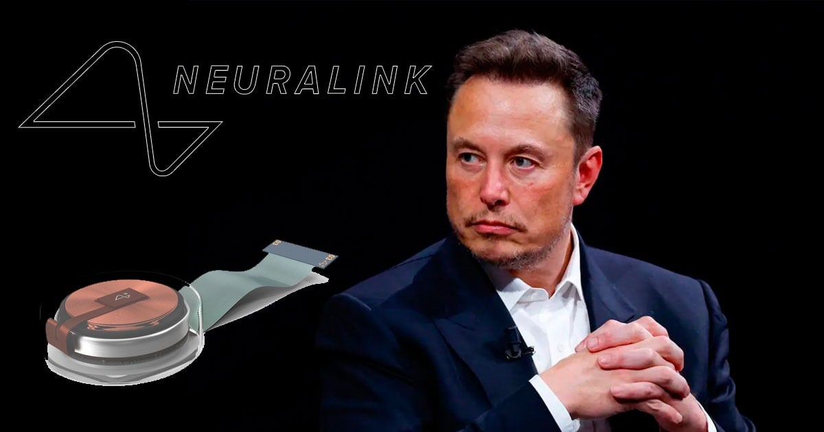 Elon Musk logra ver realizado otro gran sueño: curar enfermedades cerebrales implantando chips