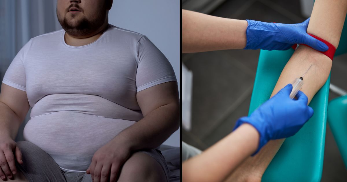 Tres recomendaciones que debe seguir si tiene niveles altos de colesterol