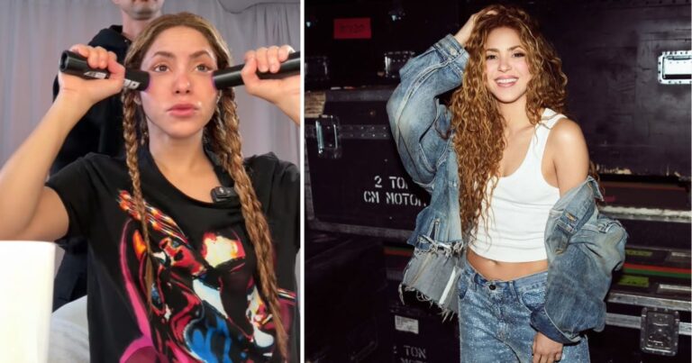 secreto de Shakira para verse joven - Un láser es el secreto de Shakira para verse joven y sin arrugas a sus 48 años ¿Cuál es y cuánto vale?