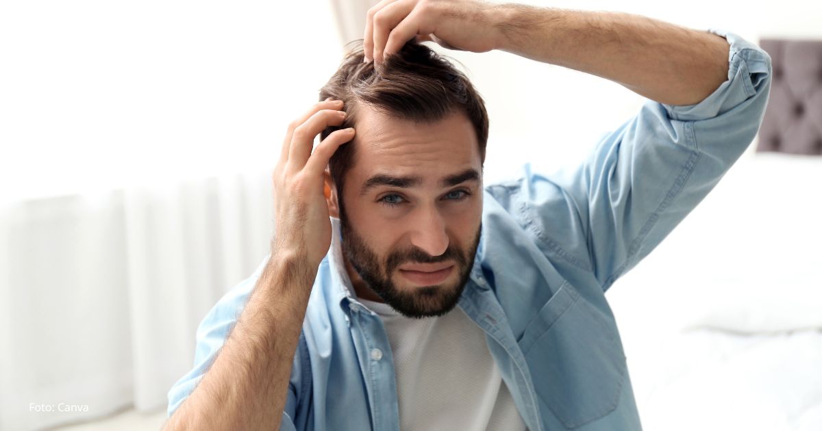 La nueva técnica que promete devolver el cabello sin necesidad de cirugía