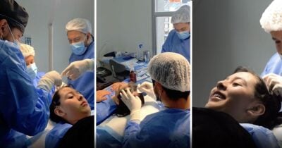 El milagro médico que busca devolverle el cabello a una joven que se quemó la cabeza con aceite a los dos años