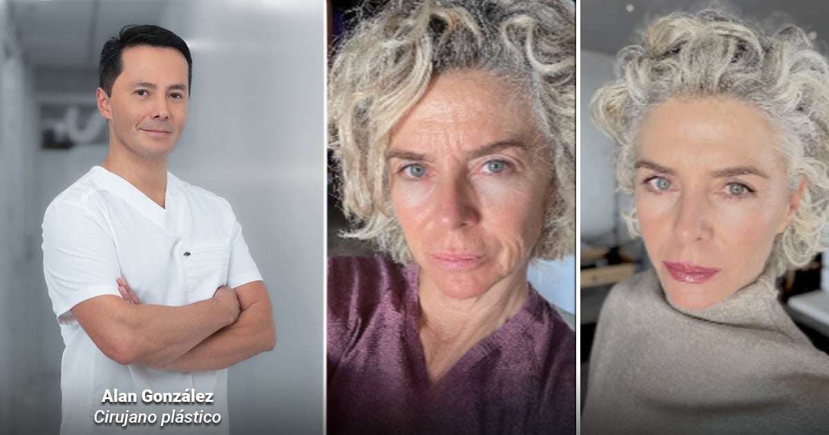  - Un cirujano bogotano rejuveneció a Margarita Rosa de Francisco y que también a Miguel Varoni